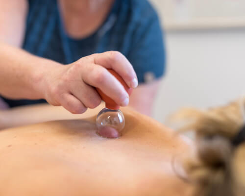 card-cupping-massage card-cupping-massage